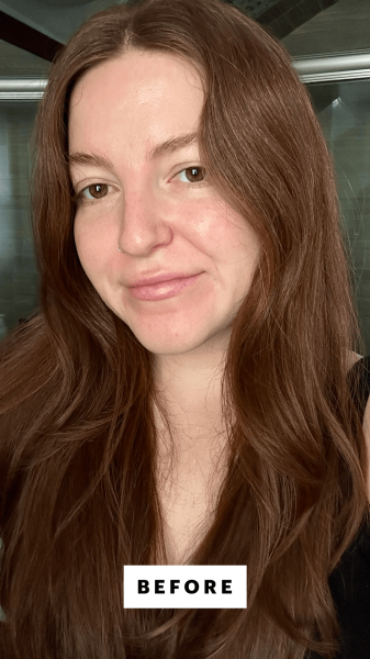 A selfie of Allure senior staff writer Elizabeth Gulino before applying the EltaMD UV Clear BlemishProne  Oil Balancing...