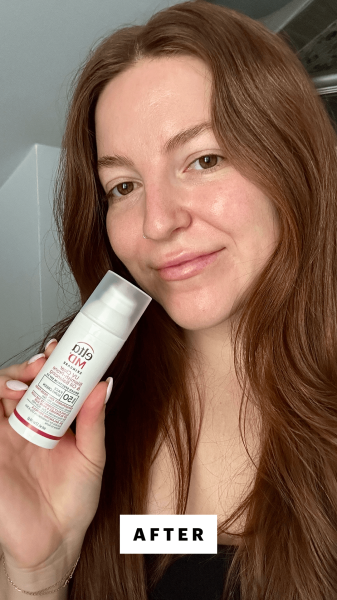 A selfie of Allure senior staff writer Elizabeth Gulino after applying the EltaMD UV Clear BlemishProne  Oil Balancing...